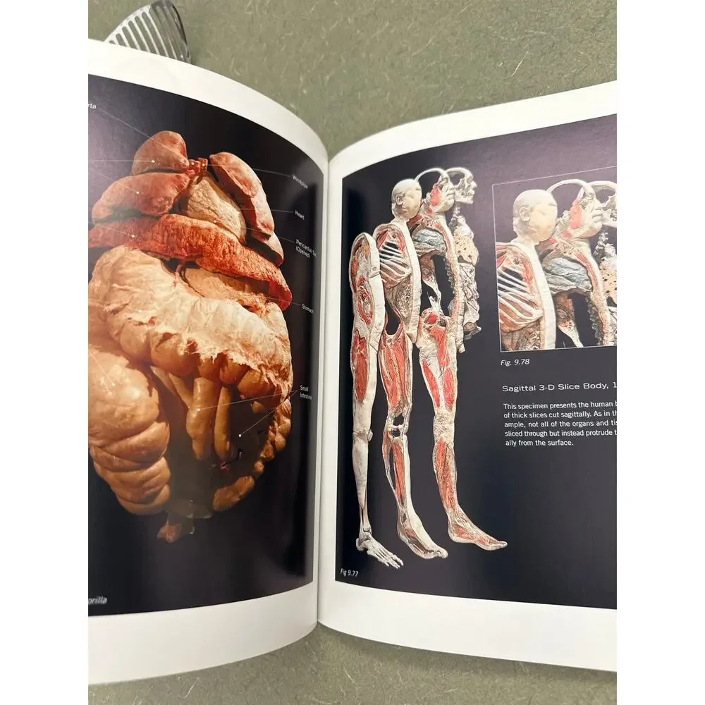 Body Worlds Anatomical Exhibition Real Human Bodies Hardcover Gunther Von Hagens